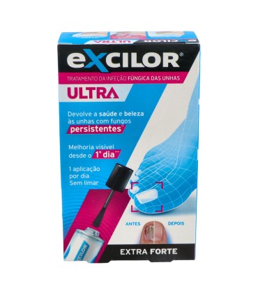 EXCILOR ULTRA SOLUCION 1 ENVASE 30 ML